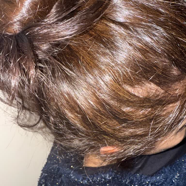 Green Therapy Saç Boyası Ciddi Kaşıntı Ve Renk Sorunu Yaşattı, Ücret İadesi İstiyorum