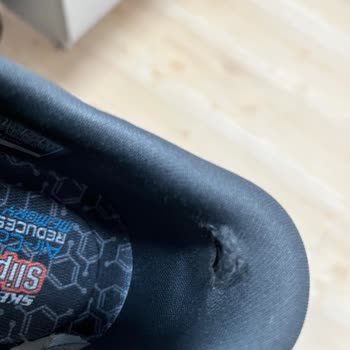 Skechers Ayakkabıda Erken Aşınma Ve Hatalı İnceleme Sonucu Hayal Kırıklığı