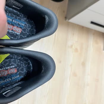 Skechers Ayakkabıda Erken Aşınma Ve Hatalı İnceleme Sonucu Hayal Kırıklığı