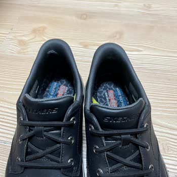 Skechers Ayakkabıda Erken Aşınma Ve Hatalı İnceleme Sonucu Hayal Kırıklığı