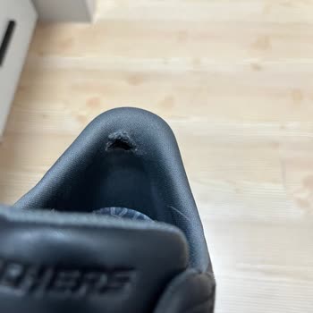 Skechers Ayakkabıda Erken Aşınma Ve Hatalı İnceleme Sonucu Hayal Kırıklığı