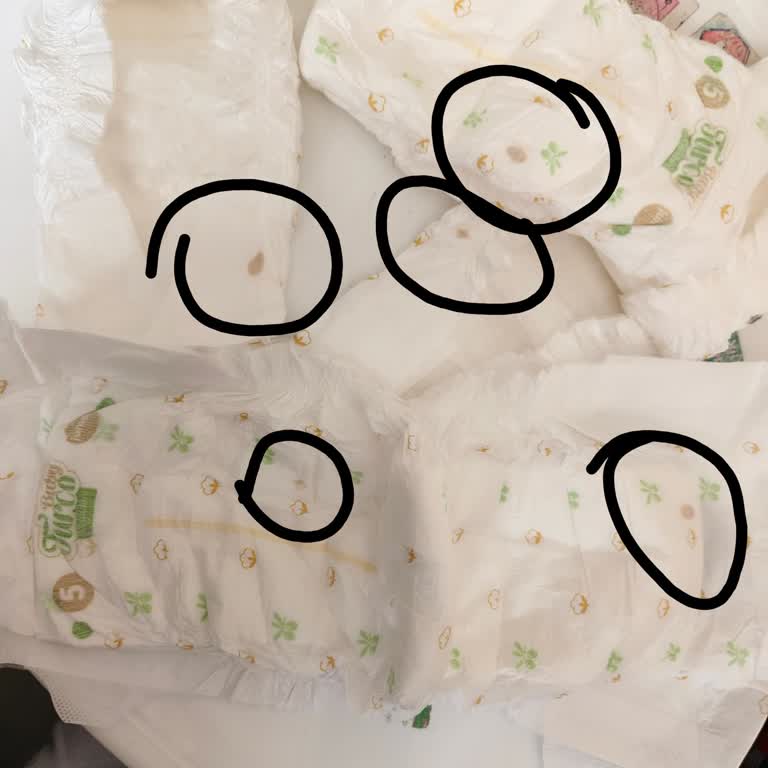 Bebek Bezlerinde Çıkan Kahverengi Lekeler Endişe Yaratıyor