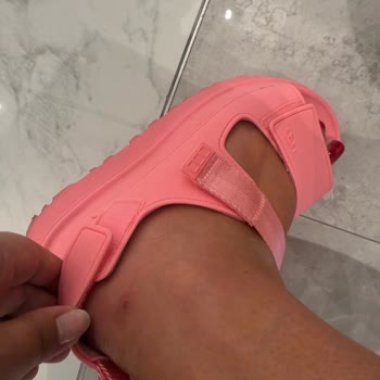 Sandalia UGG con defecto causa lesión y tienda no responde a garantía