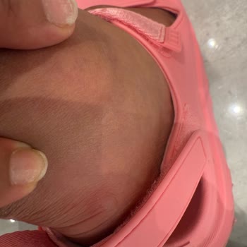 Sandalia UGG con defecto causa lesión y tienda no responde a garantía