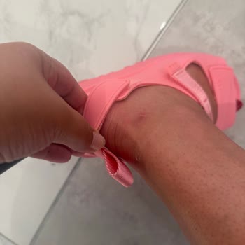 Sandalia UGG con defecto causa lesión y tienda no responde a garantía