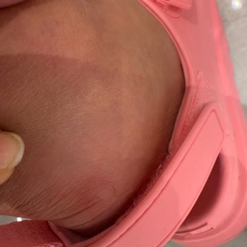 Sandalia UGG con defecto causa lesión y tienda no responde a garantía