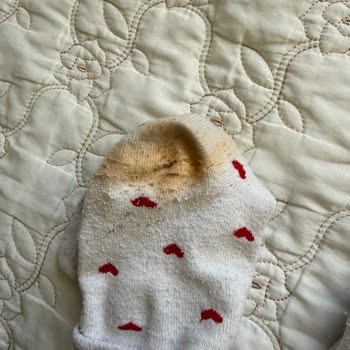 Lumberjack Ayakkabıda Renk Atması Ve İade Sorunu