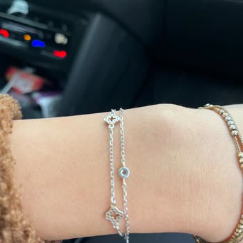 Altın Kaplama Bilekliğin Hızla Renk Değiştirmesi Ve Yetersiz Müşteri Hizmeti Nedeniyle İade Talebi