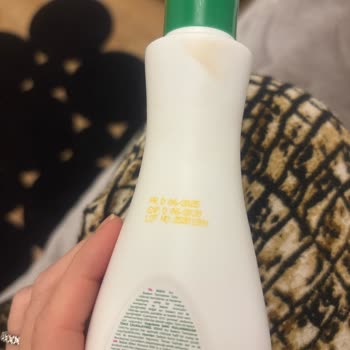 Bebak Acıbadem Sütü Kullanımı Sonrası Gözde Ciddi Tahriş Ve Enfeksiyon