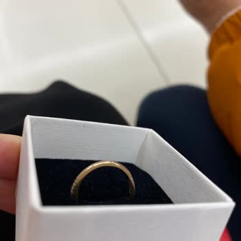 Pandora Yüzüğümün Kaplaması Soyuldu Garanti Kapsamı Dışında Bırakıldı Güvenim Sarsıldı