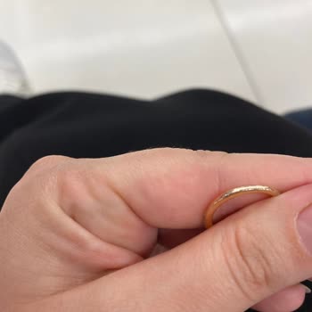 Pandora Yüzüğümün Kaplaması Soyuldu Garanti Kapsamı Dışında Bırakıldı Güvenim Sarsıldı