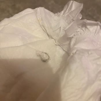 Bebek Bezinde Belirsiz Lekeler: Sağlık Endişesi Ve Açıklama Talebi