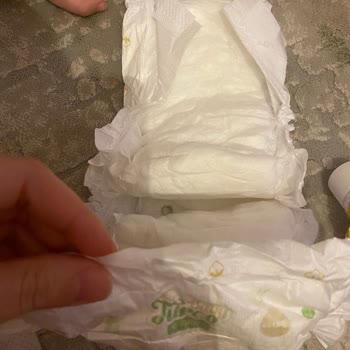 Bebek Bezinde Belirsiz Lekeler: Sağlık Endişesi Ve Açıklama Talebi