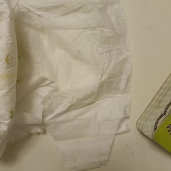 Baby Turco 5 Numara Çocuk Bezlerinde Cırt Eksikliği Nedeniyle Yaşanan Mağduriyet