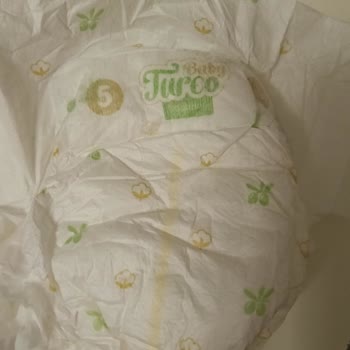 Baby Turco 5 Numara Çocuk Bezlerinde Cırt Eksikliği Nedeniyle Yaşanan Mağduriyet