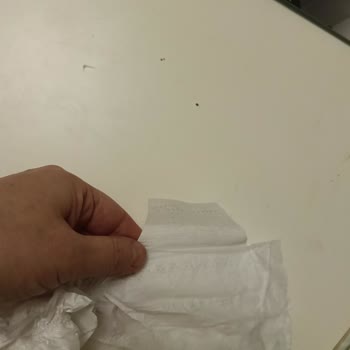 Baby Turco 5 Numara Çocuk Bezlerinde Cırt Eksikliği Nedeniyle Yaşanan Mağduriyet