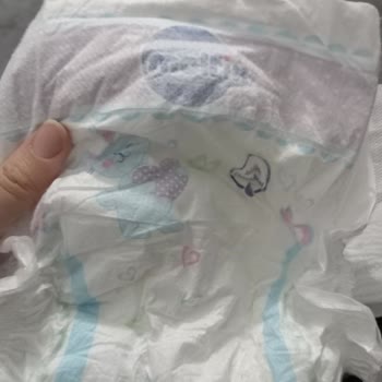 Molfix Bozuk Bebek Bezi Nedeniyle Bebeğimde Sağlık Sorunu Yaşadık