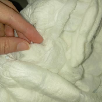 Molfix Bozuk Bebek Bezi Nedeniyle Bebeğimde Sağlık Sorunu Yaşadık