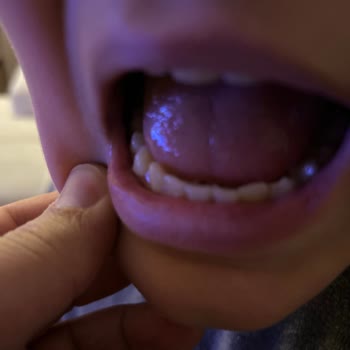 Baklavadan Çıkan Taş Oğlumun Dişini Kırdı, Güvenim Sarsıldı