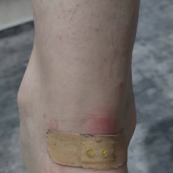 Yeni Alınan Ayakkabı Ayağımı Yaraladı, Yetersiz İnceleme Mağduriyetimi Artırdı