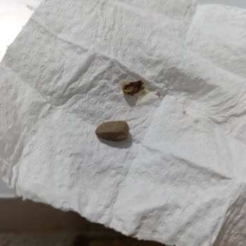 Grossa Havuç Dilimi Tatlıdan Taş Ve Ceviz Kabuğu Çıktı!