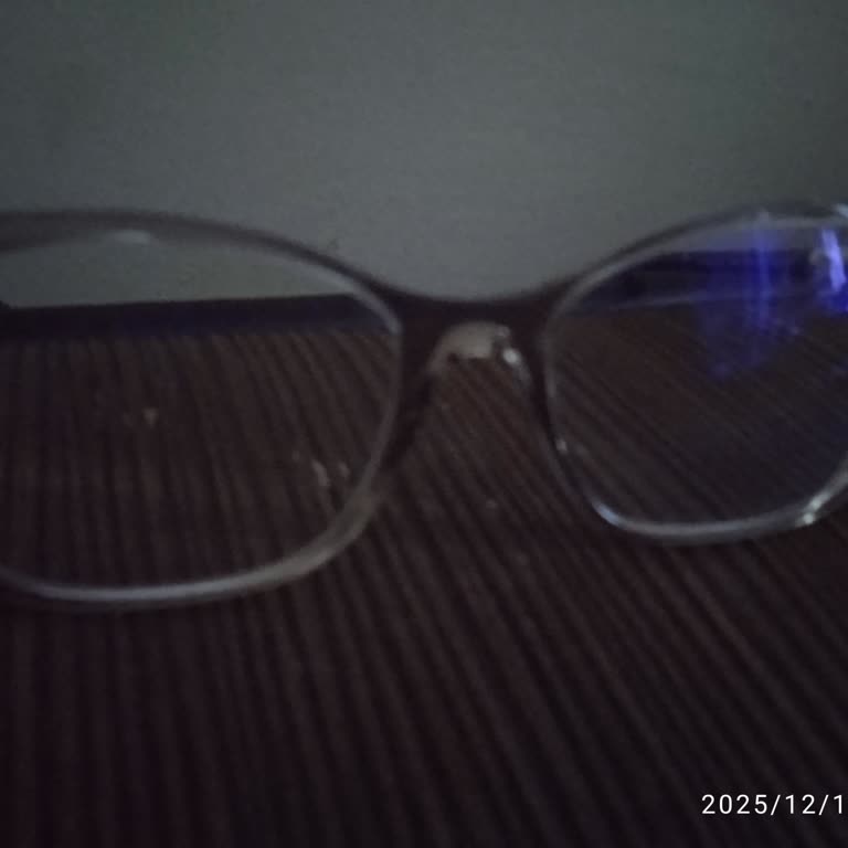 Atasun Optik'ten Aldığım Çok Odaklı Gözlükte Kalite Sorunu Ve İlgisizlik