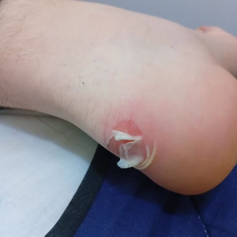 İlk Kullanımda Yaralanmaya Neden Olan Bot İçin İade Talebim Reddedildi