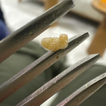 Noodle Paketinden Böcek Çıkması Güvenimi Tamamen Yok Etti