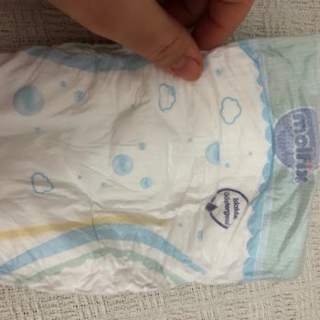 Molfix Premium Bebek Bezinde Kalite Ve İçerik Değişikliği Endişesi