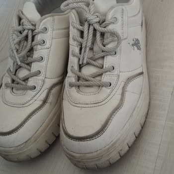 Yeni Alınan Ayakkabının Kısa Sürede Yıpranması Ve Rahatsızlık Vermesi