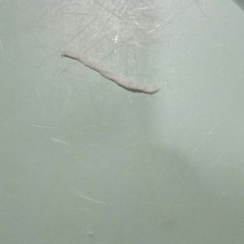 Çocuğumun Tükettiği Peynirden Çıkan Yabancı Cisimle Boğulma Tehlikesi Yaşadık