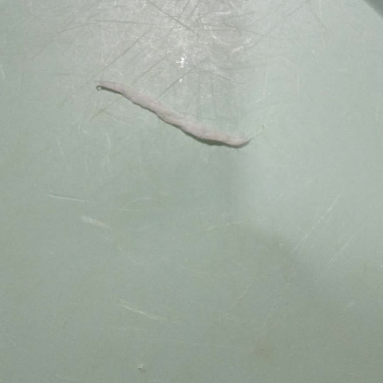 Çocuğumun Tükettiği Peynirden Çıkan Yabancı Cisimle Boğulma Tehlikesi Yaşadık