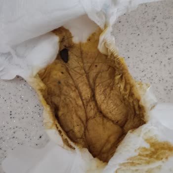 Aptamil Mama Sonrası Başlayan İshal Bebeğimin Sağlığını Olumsuz Etkiledi