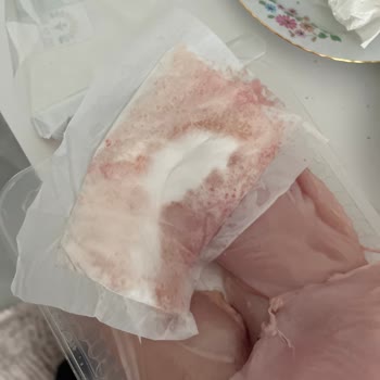 Gedik Piliç Bonfilede Hijyen Sorunu Ve Paket İçinde Yabancı Madde İle Karşılaştım