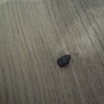 Baklavadan Çıkan Taş Dişimi Kırdı, Mağduriyetim Ciddiye Alınmalı