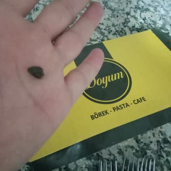 Baklavadan Çıkan Taş Dişimi Kırdı, Mağduriyetim Ciddiye Alınmalı