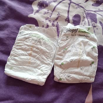 Sleepy Bebek Bezlerinde Orijinallik Ve Kalite Şüphesiyle Yaşanan Endişe