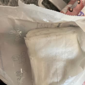 Küflü Islak Mendil Bebeğimin Sağlığını Riske Attı, İade Talebim Reddedildi