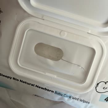 Küflü Islak Mendil Bebeğimin Sağlığını Riske Attı, İade Talebim Reddedildi