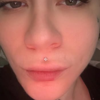 Burun Estetiği Sonrası Hayal Kırıklığı Ve Revizyon Sorunu