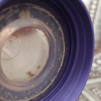 Lansinoh Biberon Ve Süt Sağma Makinesinde Tekrarlayan Küf Sorunu: Sağlık Ve Güven Endişesi