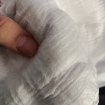 Bebek Bezi İçinde Siyah Leke: Sağlık Ve Güven Endişesi