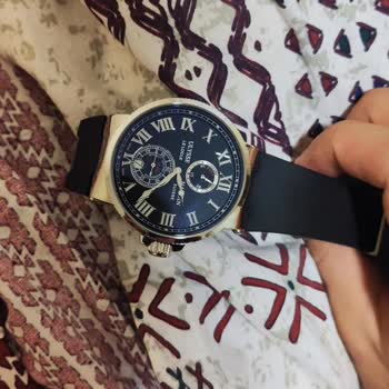 Kısa Sürede Vida Sorunu Ve Yetersiz Müşteri Desteği