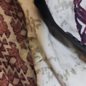 Kısa Sürede Vida Sorunu Ve Yetersiz Müşteri Desteği