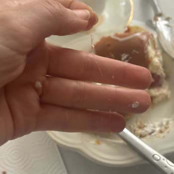 Aldığımız Pastanın İçinden Saç Çıktı Hijyen Konusunda Büyük Hayal Kırıklığı Yaşadık