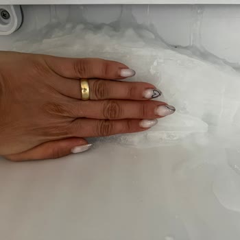 Arçelik Buzdolabında Yıllardır Süren Tekrar Eden Arıza Ve Çözümsüzlük Mağduriyeti