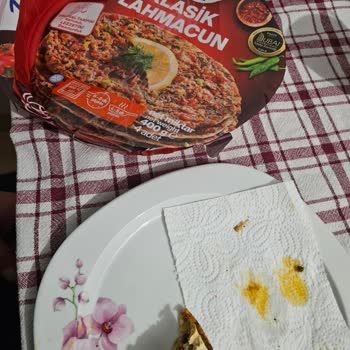 Lahmacundan Kıl Çıkması Nedeniyle Hijyen Ve Güven Sorunu Yaşadım
