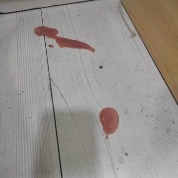 Kedimin Kuduz Aşısı Sonrası Yaşadığı Ağır Yan Etkiyle Yalnız Bırakıldım