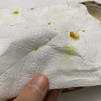 Lezzethane Ispanaklı Börekten Kıl Çıkması Nedeniyle Hijyen Ve İade Talebi