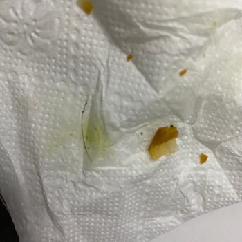 Lezzethane Ispanaklı Börekten Kıl Çıkması Nedeniyle Hijyen Ve İade Talebi